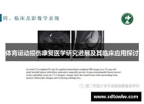 体育运动损伤康复医学研究进展及其临床应用探讨